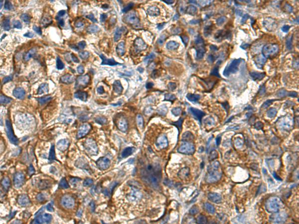 窗戶(hù)還能這樣設(shè)計(jì)，選一款美翻你的自建房！